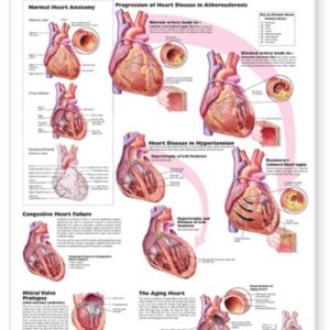 Heart Disease Chart