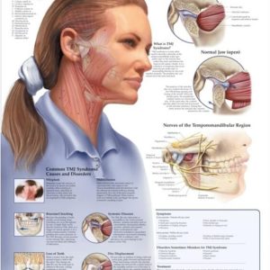 Temporomandibular Joint Syndrome Chart