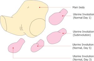 Puerperal Uterus Palpation Training Model