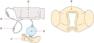 Urethral Catheterisation Model