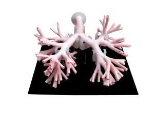 Bronchoscopy Training Model