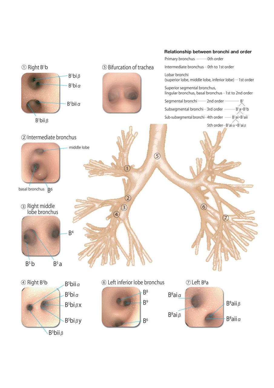 Bronchoscopy Training Model