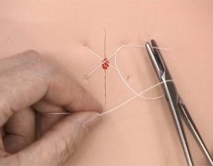 Suture Practice Kit