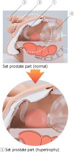 Catheterisation and Enema Simulator, Male