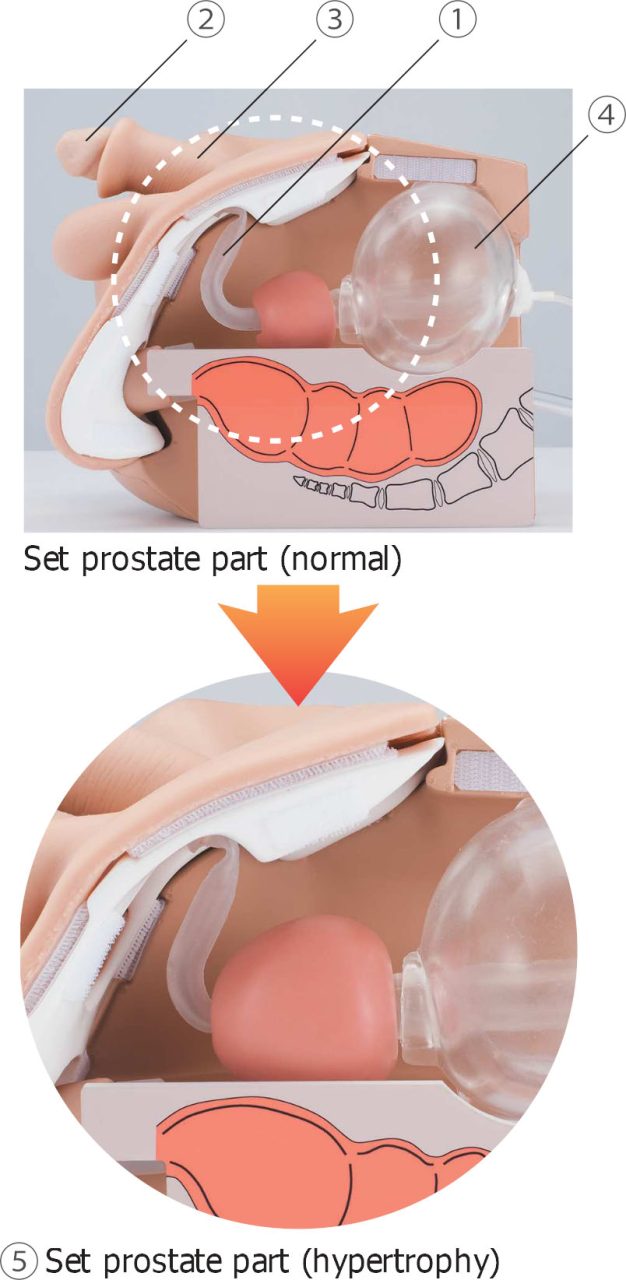 Catheterisation and Enema Simulator, Male
