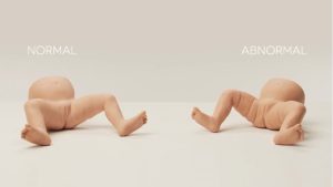 Infant Hip Examination Trainer, Light
