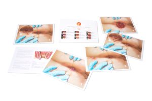 Standard Male Rectal Examination Trainer, Light