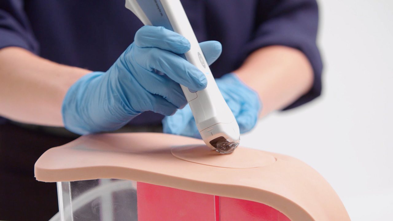 Suprapubic Insertion Unit (Ultrasound Guided), Light