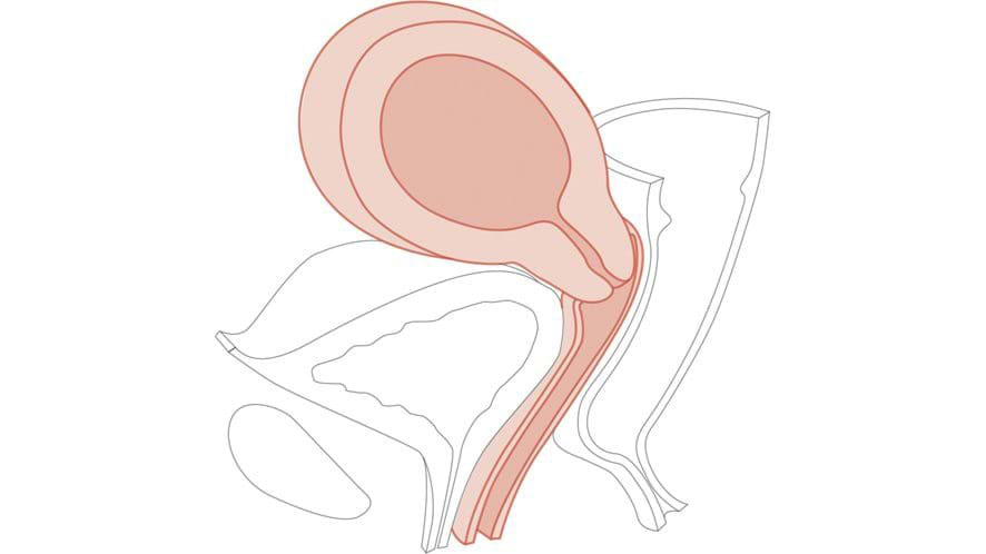 Module 6: 10-12 Weeks Pregnant