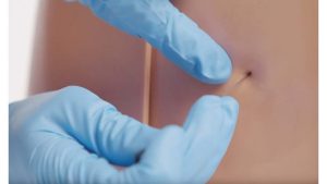 Standard Lumbar Puncture Model, Light
