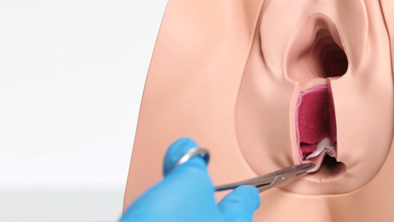 Anal Sphincter Repair Trainer, Light