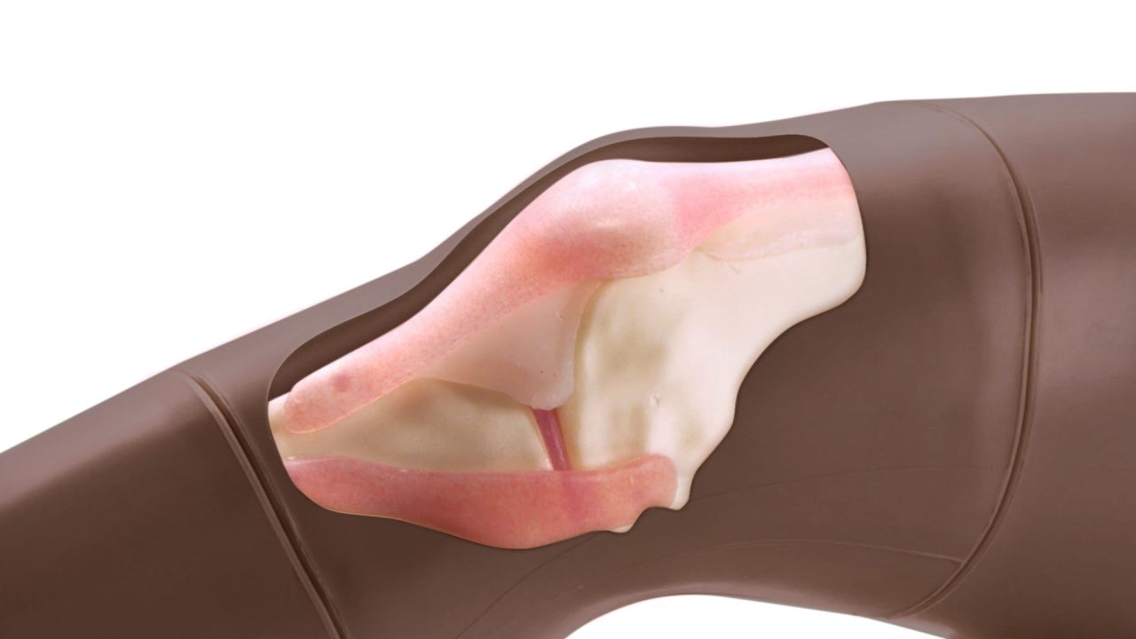 Knee Aspiration & Injection Trainer With Ultrasound Capabilities, Dark