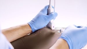 Knee Aspiration & Injection Trainer With Ultrasound Capabilities, Dark
