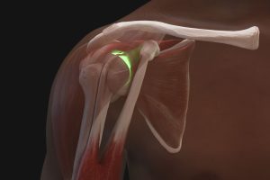 Shoulder Injection Trainer Palpation Guided with Android Tablet, Light