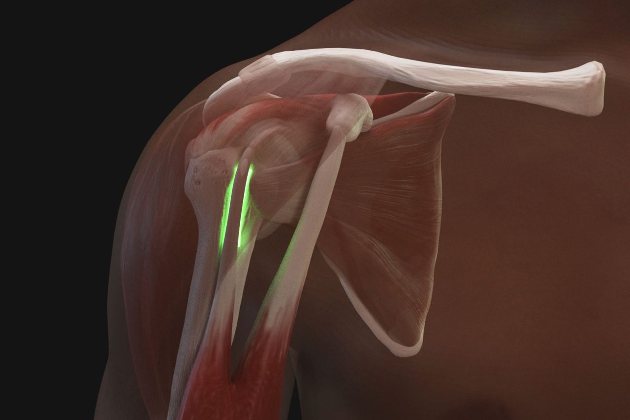Shoulder Injection Trainer Palpation Guided with Android Tablet, Light