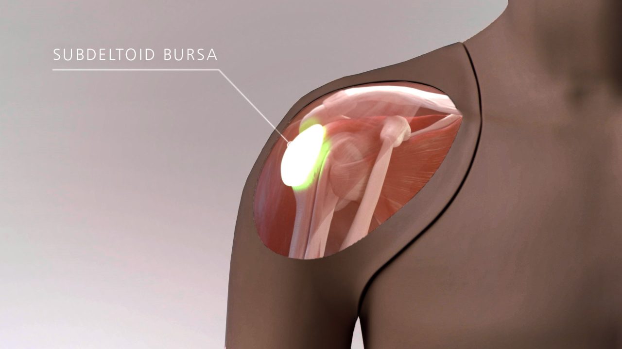 Shoulder Injection Trainer Ultrasound Guided, Dark