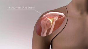 Shoulder Injection Trainer Ultrasound Guided, Dark