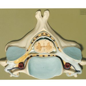 Fifth Cervical Vertebra