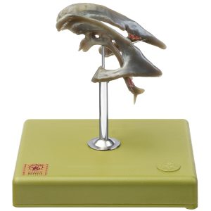 Ventricular Cavities of the Brain