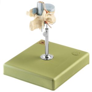 Lumbar Vertebra (L II) With Lumbar Region of Spinal Cord