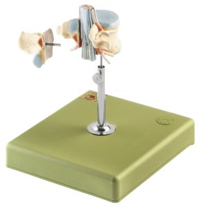 Lumbar Vertebra (L II) With Lumbar Region of Spinal Cord