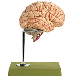 Brain With Arteries - Separates Into 9 Parts