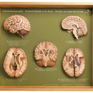 5 Section Models of the Brain