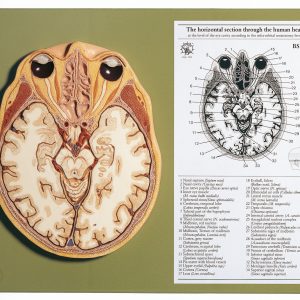 Horizontal Section of the Head at the Plane of the Orbit