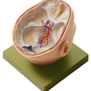 Situs of the Base of the Skull, Light