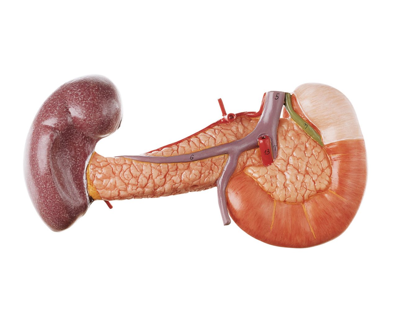 Pancreas With Spleen and Duodenum