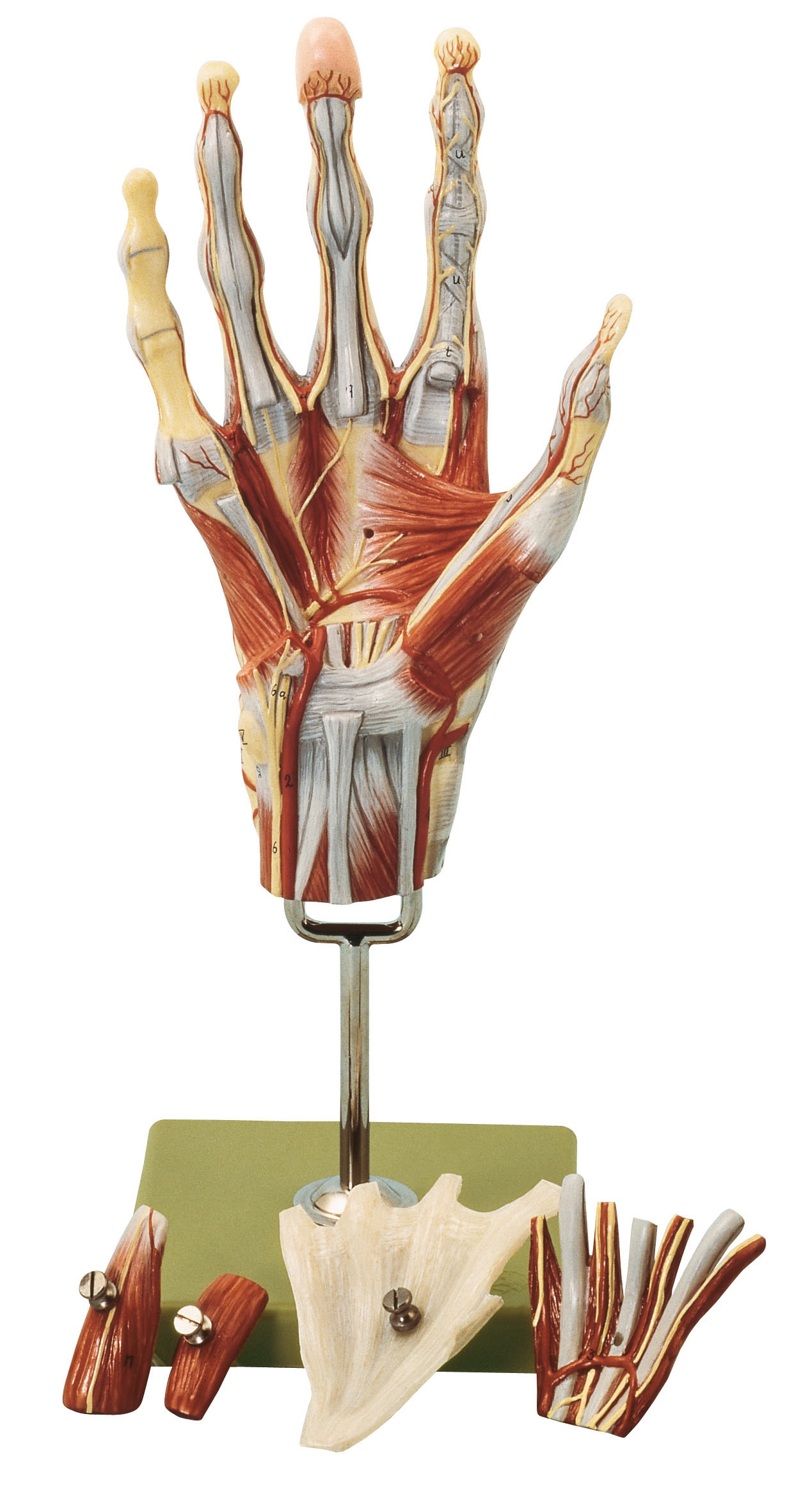 Muscles of the Hand With Base of the Forearm, Light