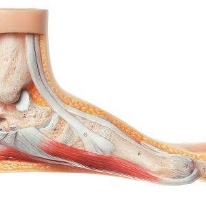 Hallux Valgus Model, Light