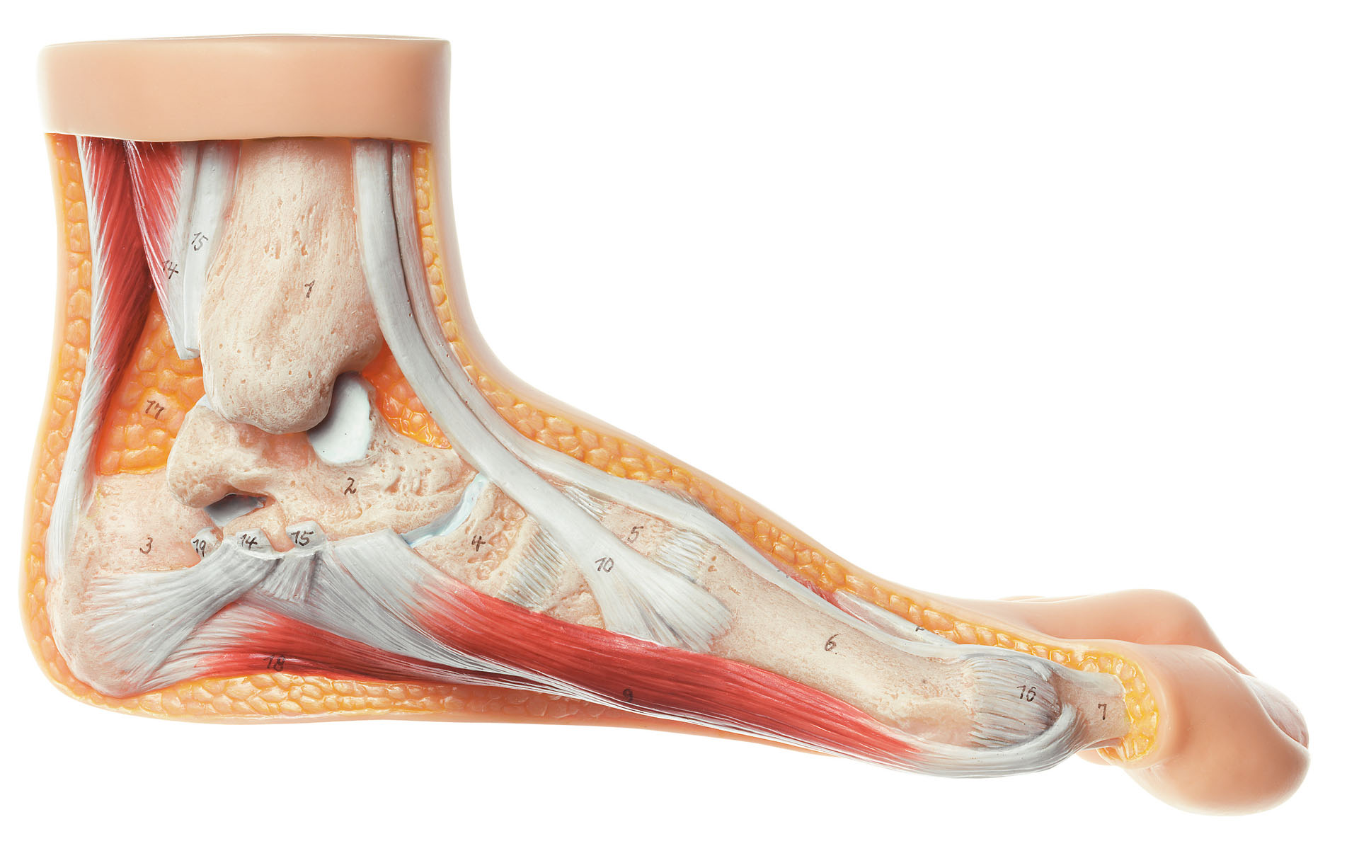 Hallux Valgus Model, Light