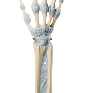 Joints of Hand and Fingers With Ligaments