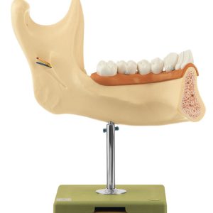 Lower Jaw of an 18-Year-Old