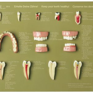 Case of Teeth "Keep Your Teeth Healthy"
