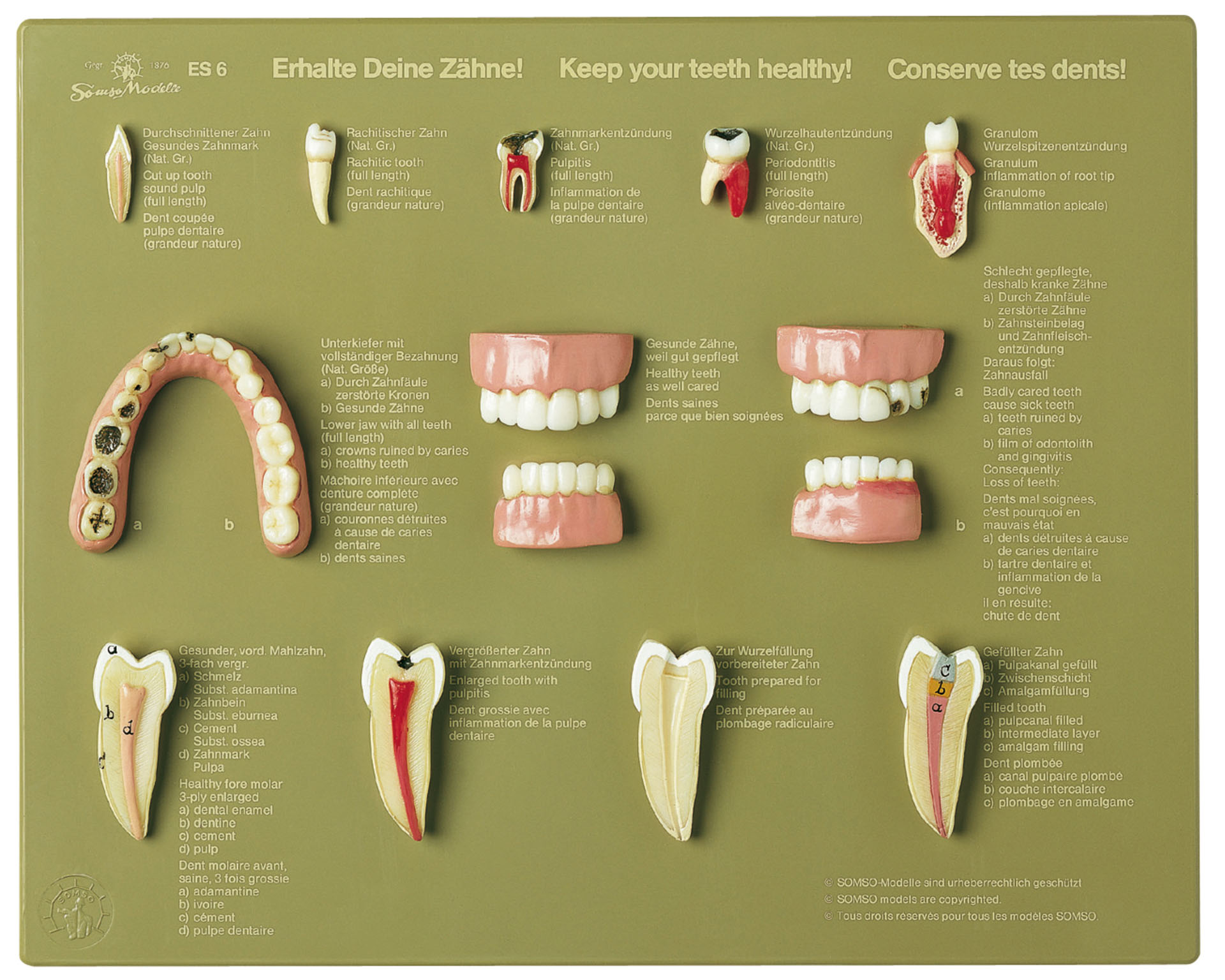 Case of Teeth “Keep Your Teeth Healthy”