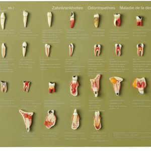 Case of Teeth "Odontopathies"