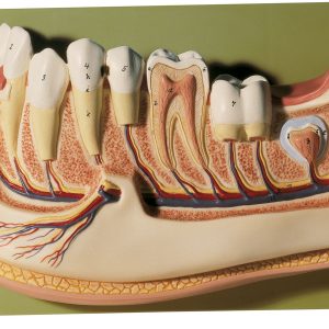 Lower Jaw of a 12-Year-Old, Light