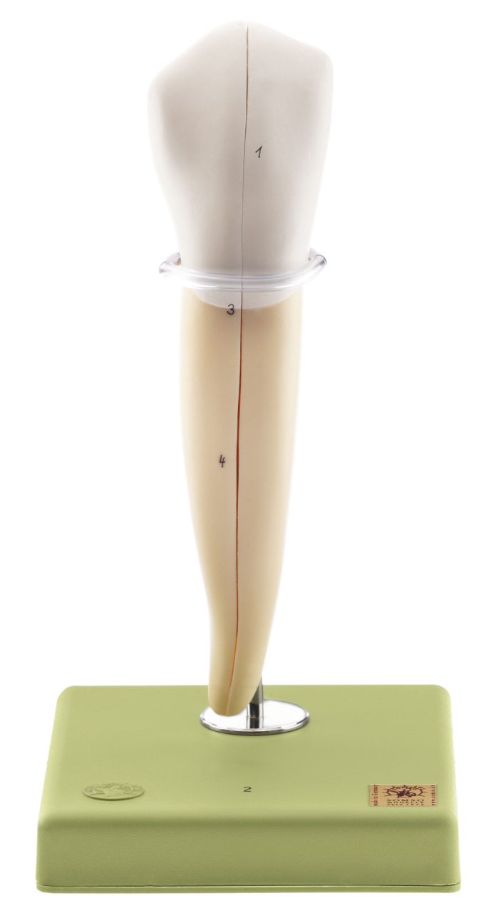 Lower Canine