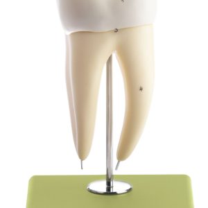 Lower Molar With Two Roots