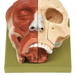 Nose and Nasal Cavities