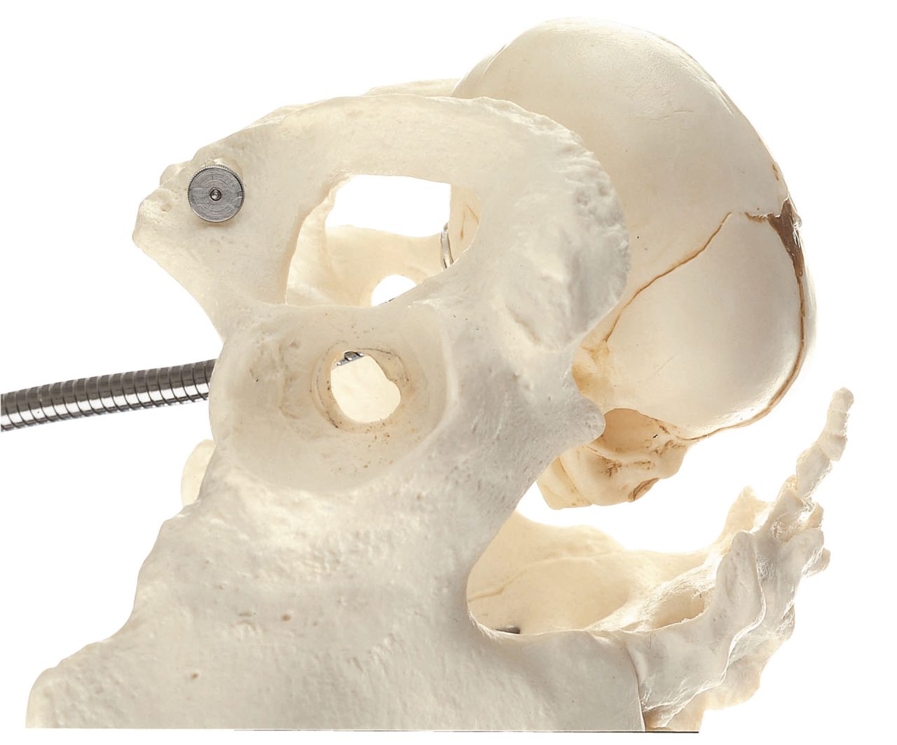 Obstetric Phantom