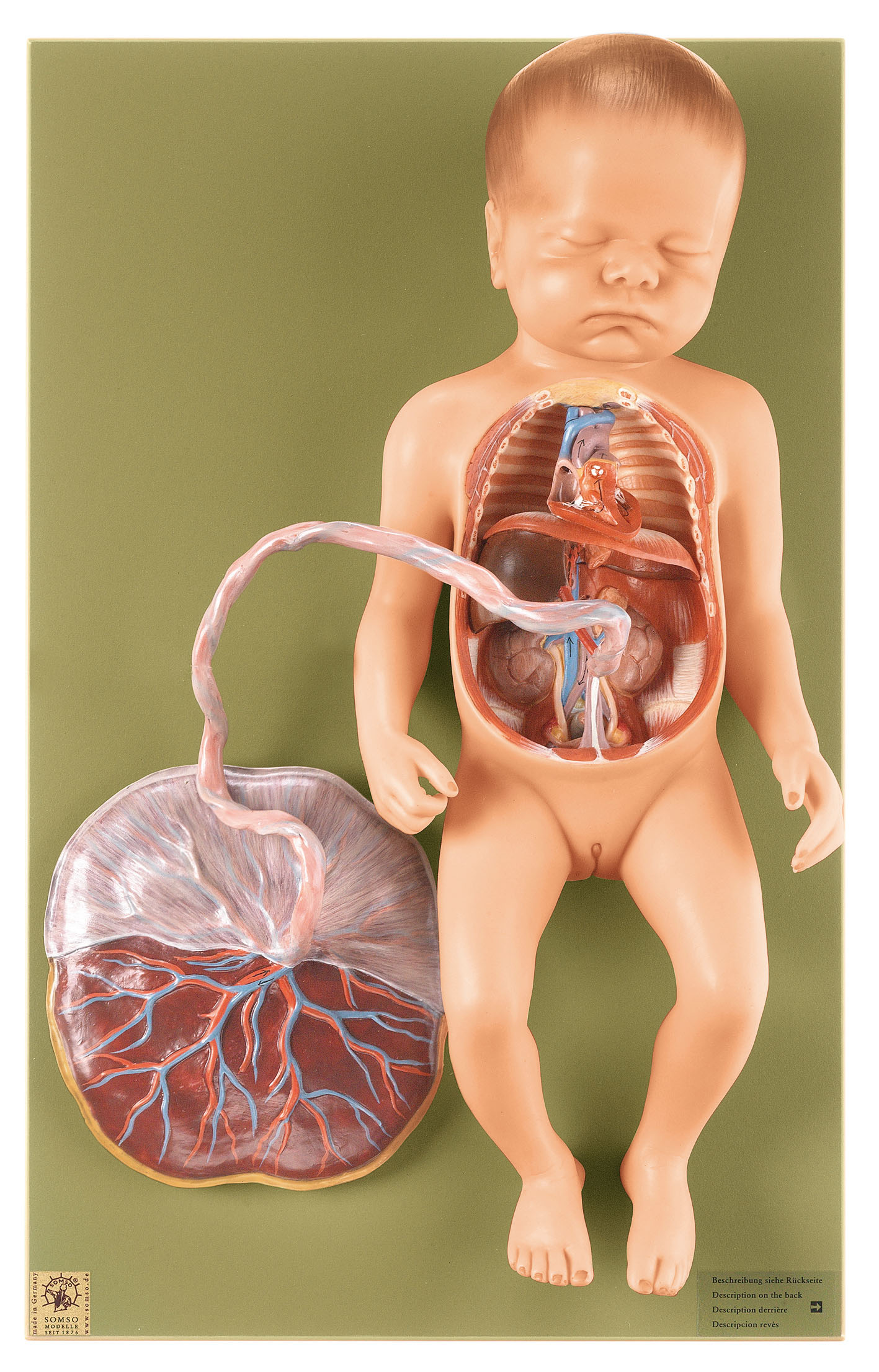 Fetal Circulatory System, Light