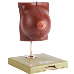 Mammary Gland in Resting Position, Dark