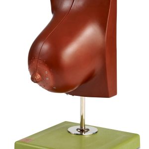 Mammary Gland of a Breastfeeding Woman, Dark