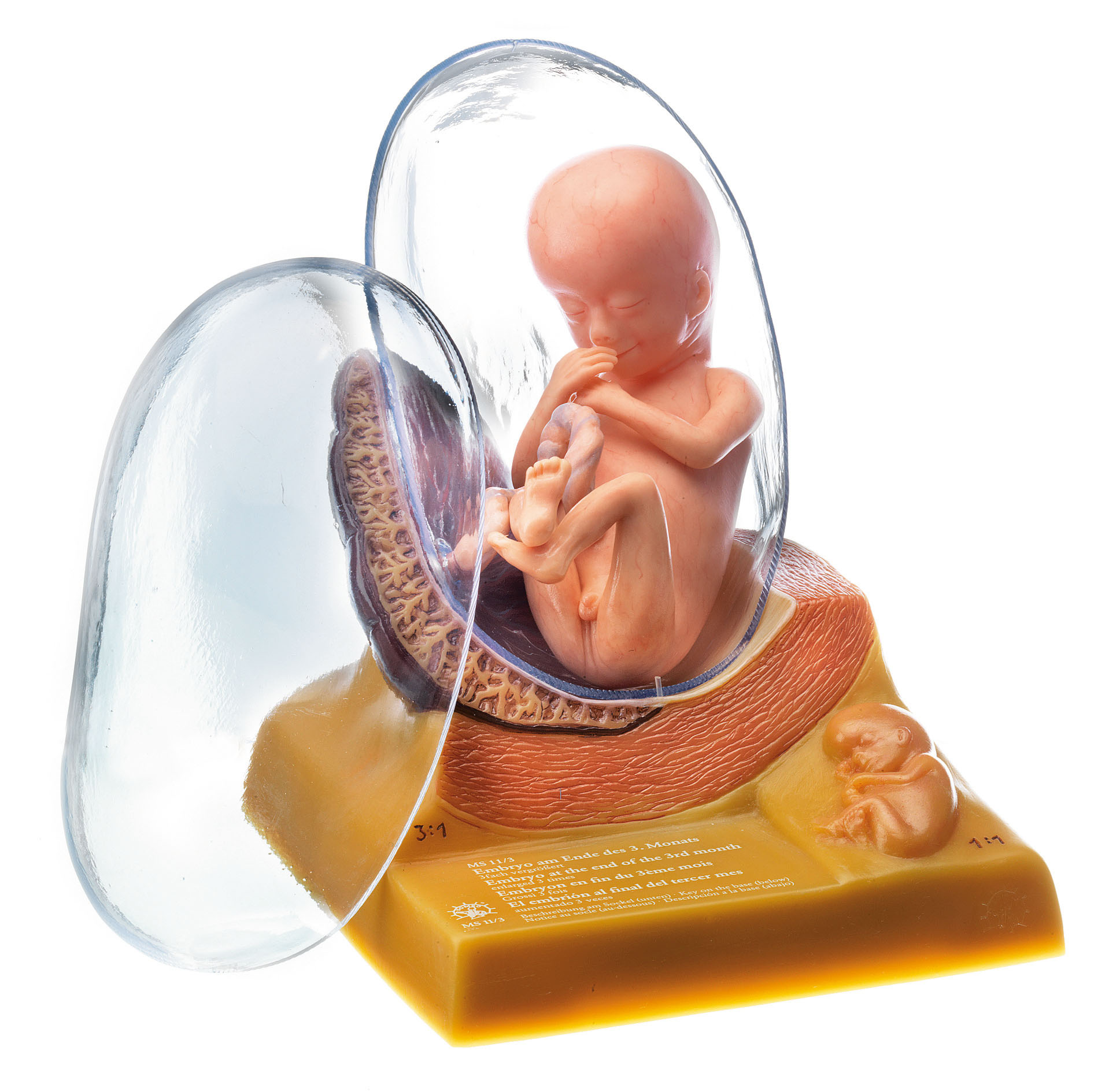 Human Embryo in the Third Month