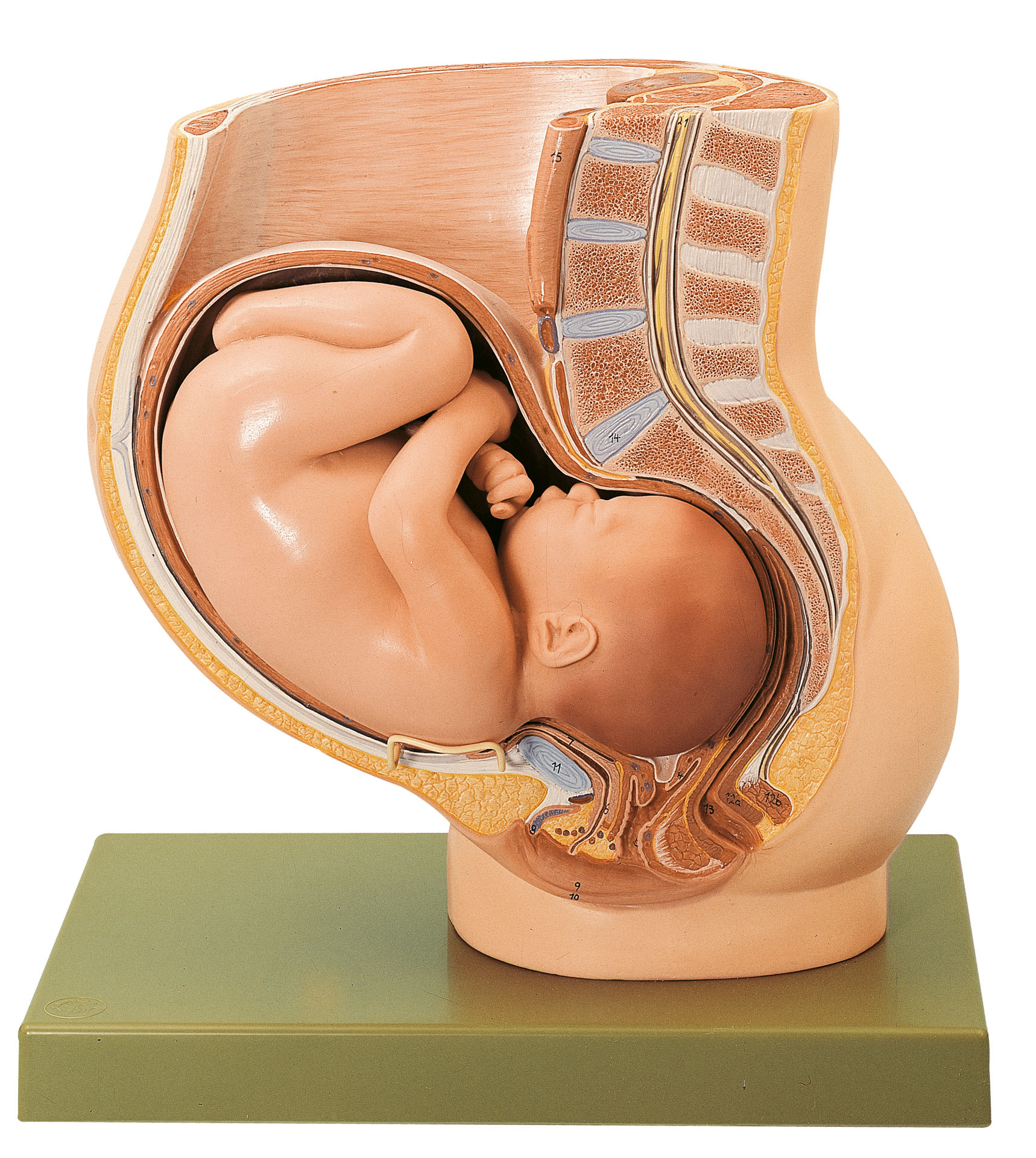 Pelvis With Uterus in Ninth Month of Pregnancy, Light