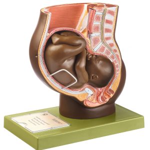 Pelvis With Uterus in Ninth Month of Pregnancy