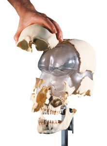 Artificial Bauchene Skull of an Adult